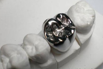 Металлическая зубная коронка