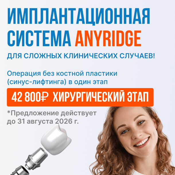 AnyRidge 