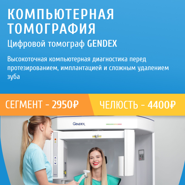 Компьютерная томограмма