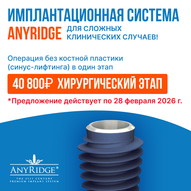 Премиум-импланты зубов AnyRidge 