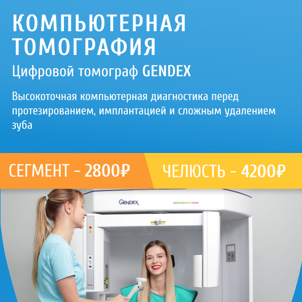 Компьютерная томограмма