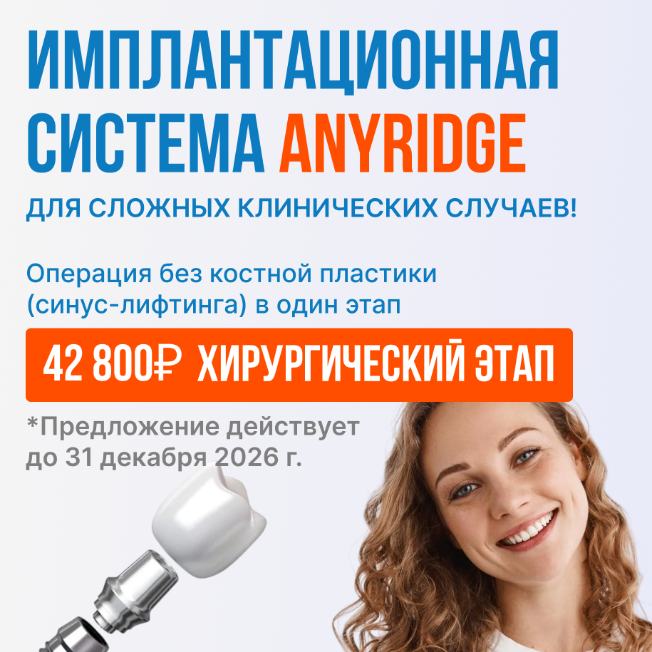 AnyRidge 