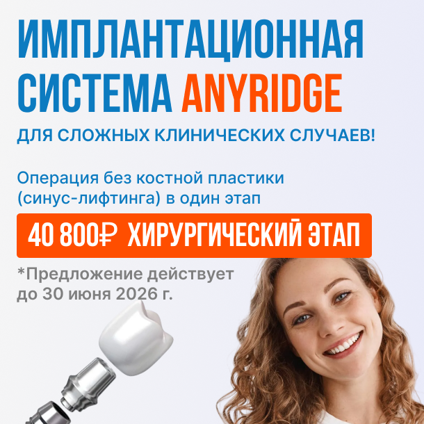 AnyRidge 