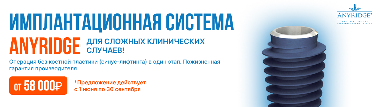 object_name