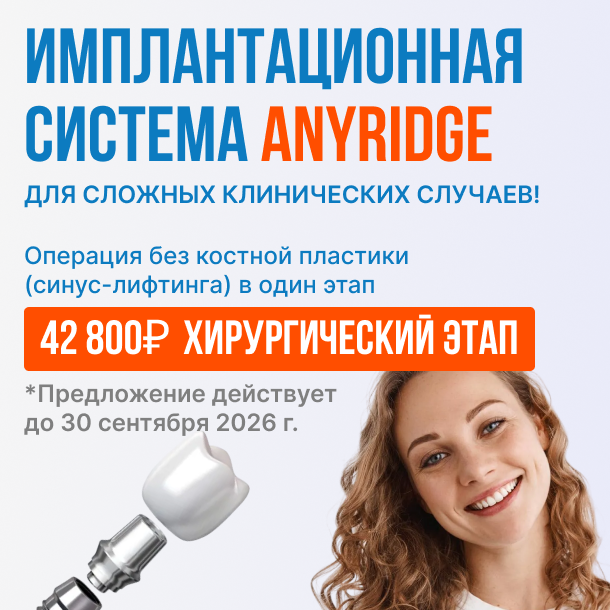 AnyRidge 