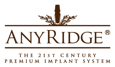 Импланты AnyRidge