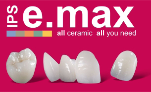 Безметалловая керамика IPS e.max