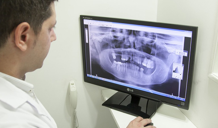 Диагностика зубов (рентген, ОПТГ, КТ, 3d снимок)