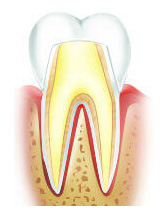 Керамическая коронка на зубе
