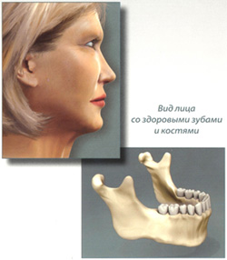 Вид лица со здоровыми зубами и костями