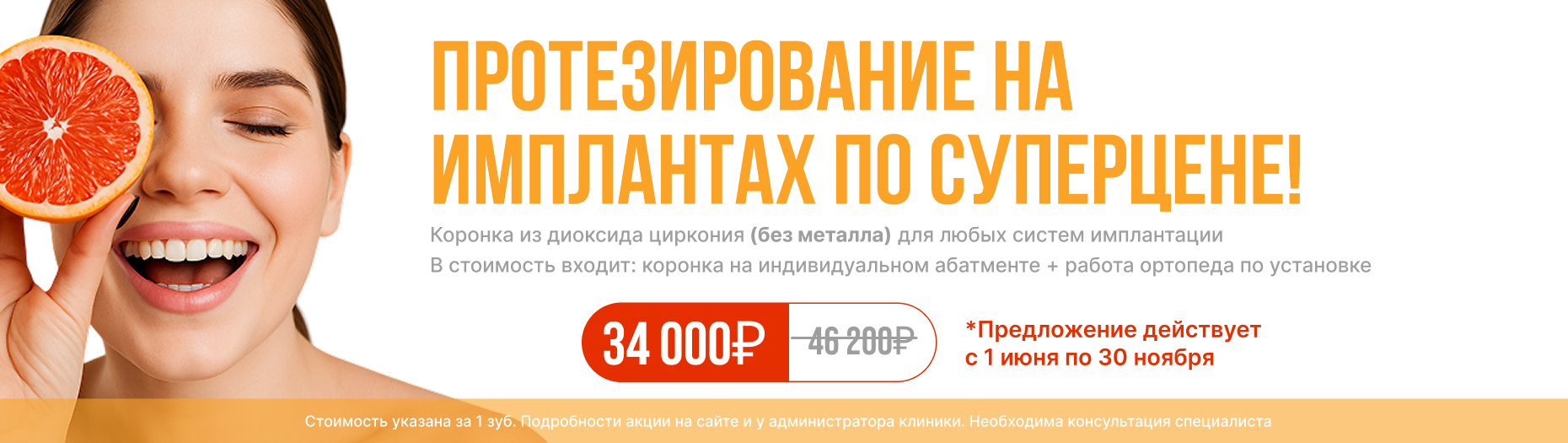 Протезирование на имплантах