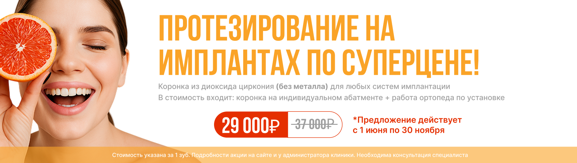 Протезирование на имплантах