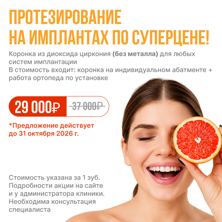 Протезирование на имплантах