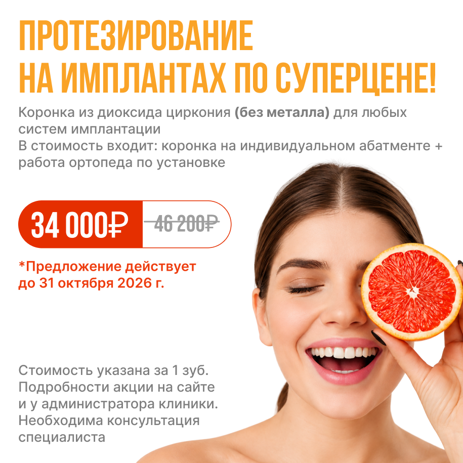 Протезирование на имплантах