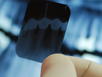 Рентген зуба: зачем делать его и опасно ли это?
