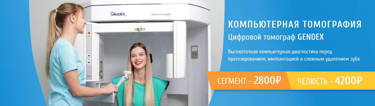 Компьютерная томограмма