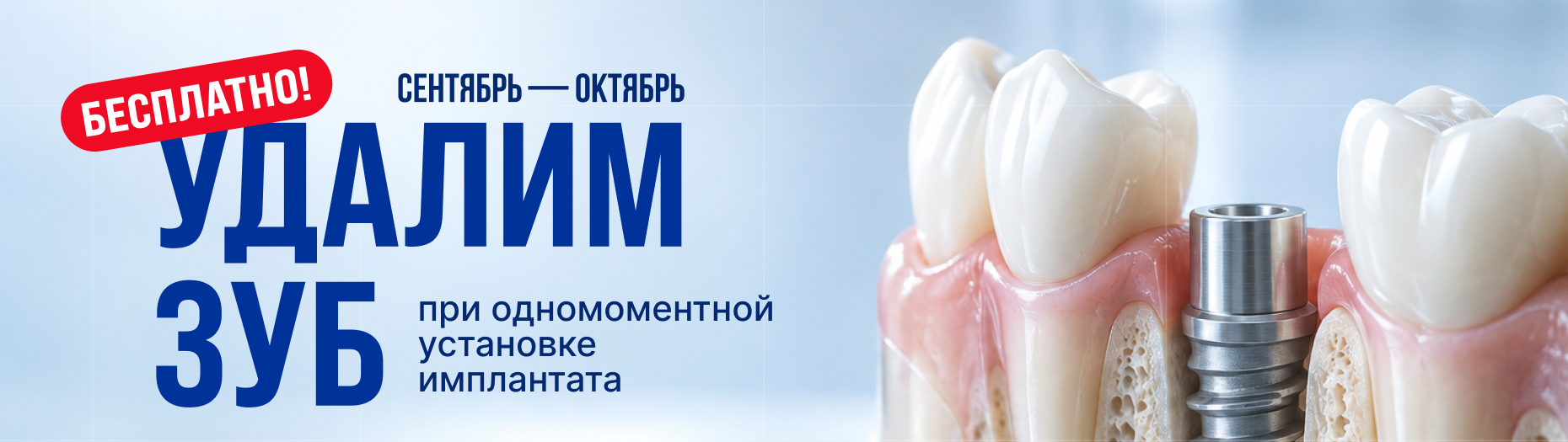 Удалим зуб при установке импланта