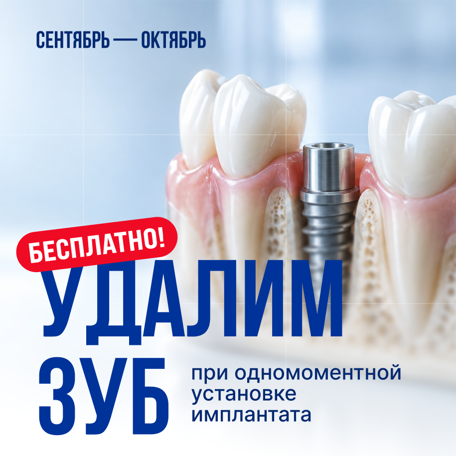 Удалим зуб при установке импланта